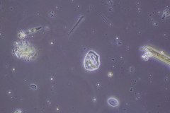 Amoebozoa