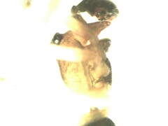 Agyneta simplicitarsis