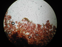 Physarum melleum