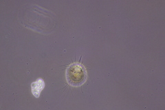 Amoebozoa