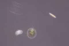 Amoebozoa