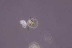 Amoebozoa