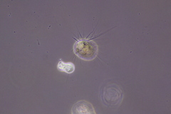 Amoebozoa