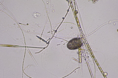 Amoebozoa