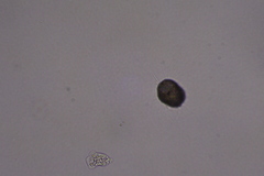 Amoebozoa