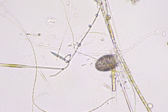 Amoebozoa