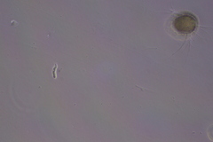 Amoebozoa