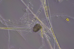 Amoebozoa