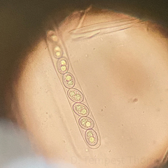 Adelphella babingtonii