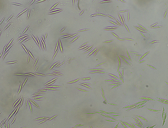 Monoraphidium tortile
