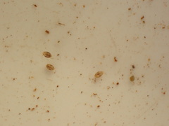 Ostracoda