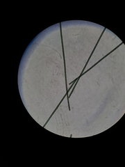 Planktothrix