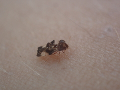 Tingidae
