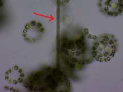 Planktothrix