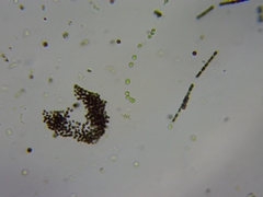 Microcystis
