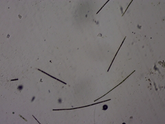 Dolichospermum planctonicum