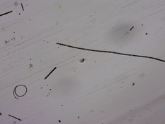 Dolichospermum planctonicum