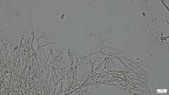 Dacrymycetaceae
