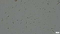 Dacrymycetaceae