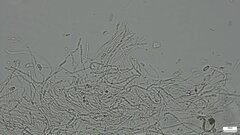 Dacrymycetaceae