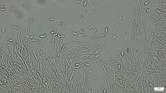Dacrymycetaceae