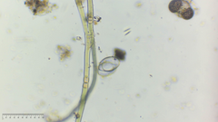 Cosmarium