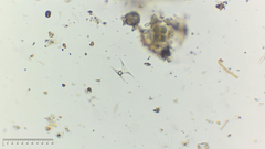 Staurodesmus triangularis