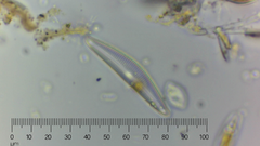 Cymbella
