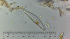 Cymbella