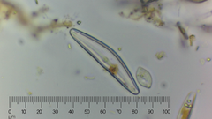 Cymbella