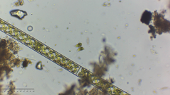 Staurodesmus dejectus