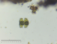 Staurastrum polytrichum