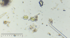 Euastrum denticulatum