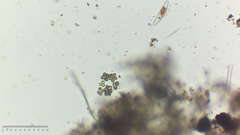 Radiococcaceae