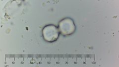 Cosmarium