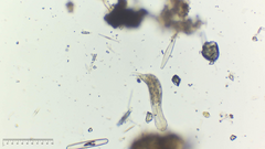 Lepidodermella