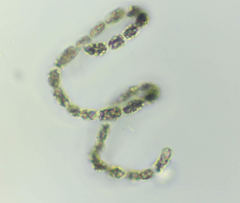 Dolichospermum