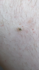 Corythucha marmorata