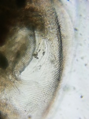 Simocephalus