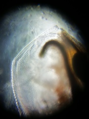 Simocephalus