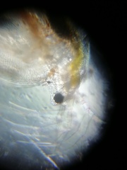 Simocephalus