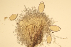 Bactridium ellisii