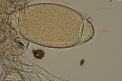 Bactridium ellisii