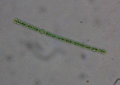 Dolichospermum