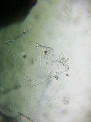 Simocephalus