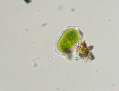 Cylindrocystis