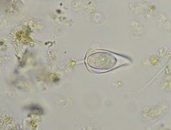 Cothurniopsis valvata