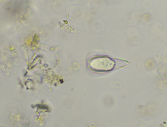 Cothurniopsis valvata