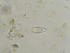 Cothurniopsis valvata