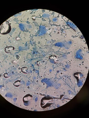 Aspergillus